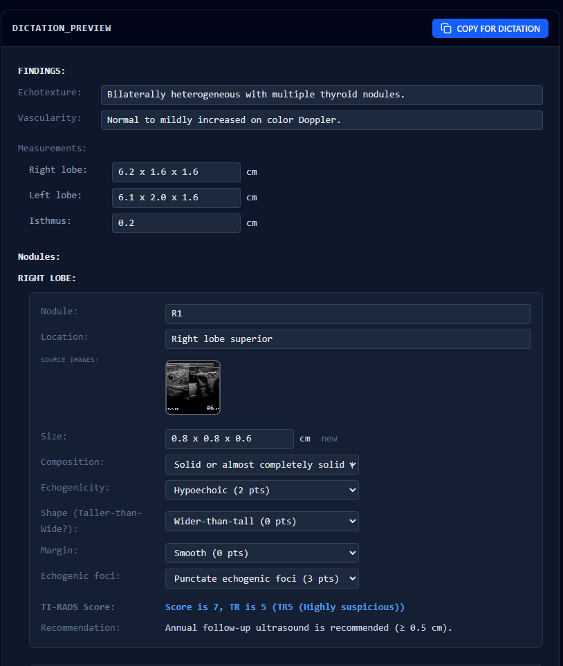 Structured dictation preview